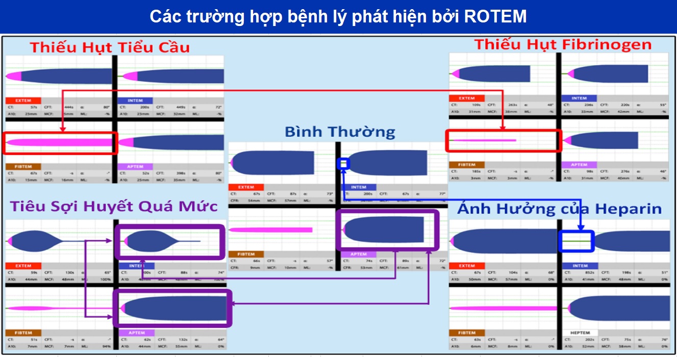 6. Tương Lai Của Xét Nghiệm Rotem